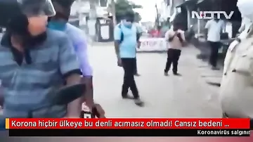 Koronavirusdan ölən anasının cəsədini belə daşıdı