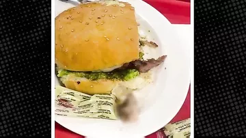 Ətçəkən maşında iki barmağı qaldı, xəbəri olmadı - hamburgerdən çıxdı