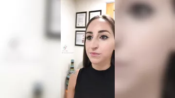 Burun əməliyyatı ilə tamamilə başqa biri oldu