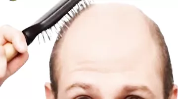 Saç tökülməsinin ciddi səbəbləri var