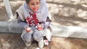 İran polisi körpə qızı qanına qəltan etdi