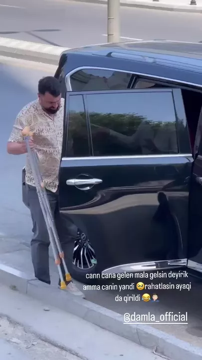 Azərbaycanın məşhur müğənnisi ayağını sındırdı