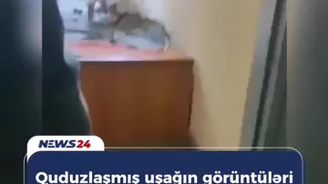 Quduzlaşmış uşağın vəziyyəti necədir?