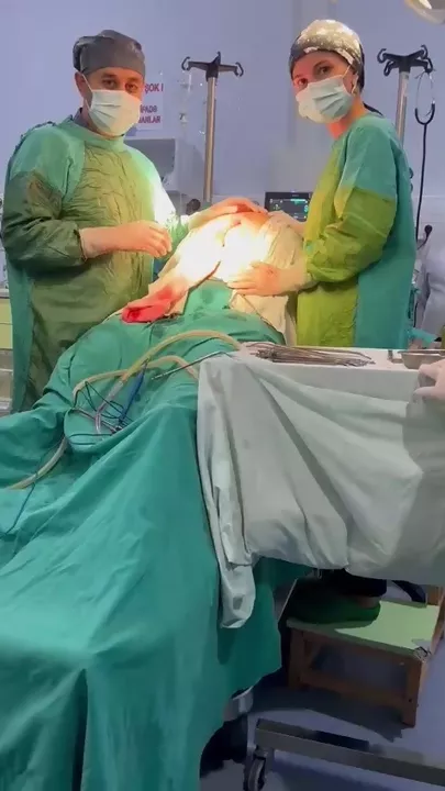 Azərbaycanda xəstənin qarnından 32 kq-lıq kista çıxarıldı