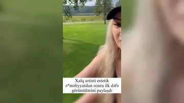 Məleykə Əsədova estetik əməliyyatdan sonra BELƏ OLDU