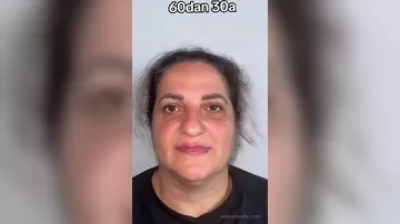 60 yaşlı qadını əməliyyatla bu hala saldılar