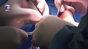 Boğazgərmə əməliyyatı etdirən qadının üzü əyildi