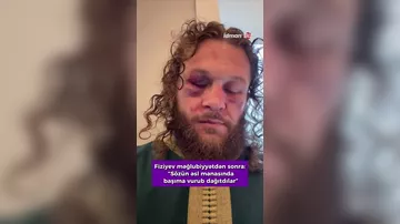 Рафаэль Физиев высказался после поражения от Маурисио Руффи