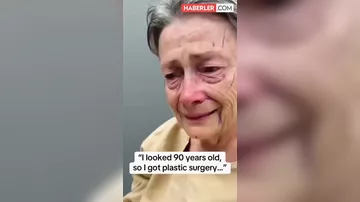 Estetik əməliyyatdan sonra inanılmaz dəyişim: Sanki başqa bir insan oldu