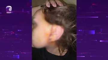 Daha bir estetik mərkəzdə QALMAQAL - Eyni həkimdən 3 pasiyent şikayət etdi