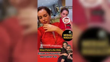 Dilan Polatı əri DÖYÜB?