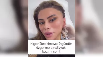 Üzgərmə əməliyyatı etdirən Nigar İbrahimova müzakirə mövzusuna çevrildi