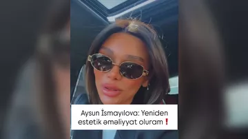 Gözəlləşmək üçün yenə cərrah bıçağı altına uzanacaq