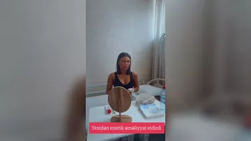 Aysun yenidən estetik əməliyyat etdirib