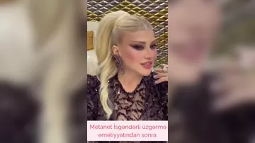 Üzgərdirmədən sonra belə OLDU