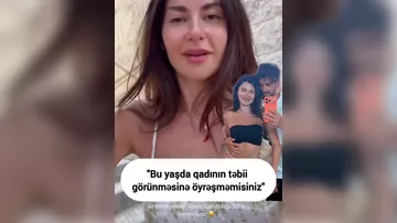 "Botoks etdirməyimdən kimə nə?"