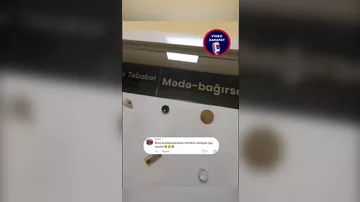 Mədədən çıxan yad cisimlər