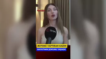 Estetik etdiren qadin heyatini sokunu yasadi