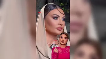 Şəbnəm Tovuzlu tanınmaz halda