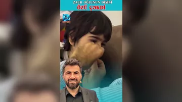 Zaur Baxşəliyev oğlu Davudun dişini özü çəkib