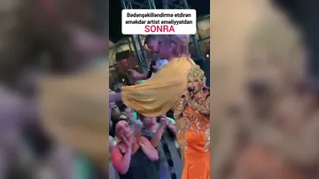 Əməkdar artist bədənşəkilləndirmə əməliyyatdan sonra