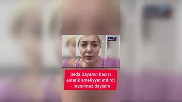 Seda Sayanın bacısı əməliyyatdan sonra bu hala qaldı