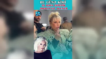 35 dəfə estetik əməliyyat keçirən Ajda