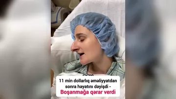 11 min dollara burun əməliyyatı etdirib