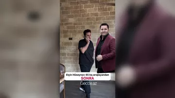 Müğənni Elçin Hüseynov son görünüşü ilə diqqət çəkib