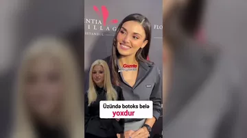 Hande Erçel bu dəfə görünüşü ilə bağlı danışıb