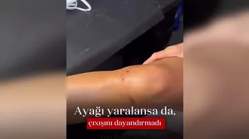 Nikol Şerzinge ayağı yaralansa da, çıxışını dayandırmadı