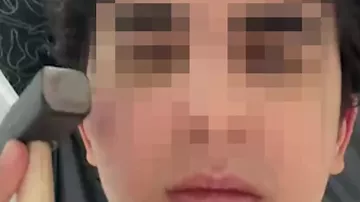 Gənclər arasında yeni trend yarandı: Çəkiclə üzlərinə vururlar (1)