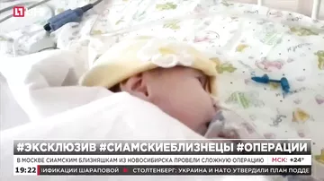 В Москве сиамским близняшкам из Новосибирска провели сложную операцию
