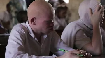 Впервые прошел конкурс красоты для альбиносов