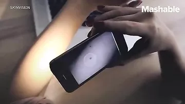 Мобильное приложение диагностирует рак кожи
