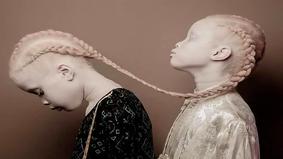 Близнецы-альбиносы покоряют мир высокой моды