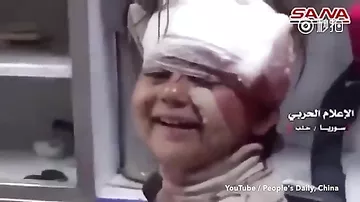 Пользователей Сети поразила улыбка раненной во время взрыва сирийской девочки