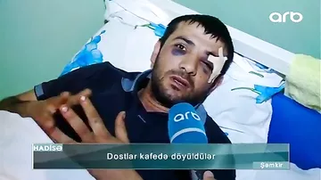 "Kofeni üstümə töküb, bakalı başıma vurdu" - 2 dost kafedə döyüldü