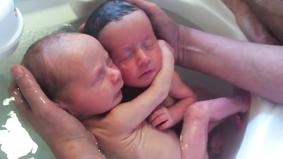 Эти новорожденные близнецы обнимаются!