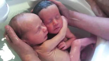 Эти новорожденные близнецы обнимаются!