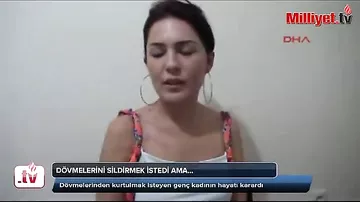 Döymələrini sildirmək istəyən gənc qadının həyatı qaraldı