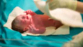 Опытные врачи-акушеры шокированы: женщина родила ребёнка-русалку