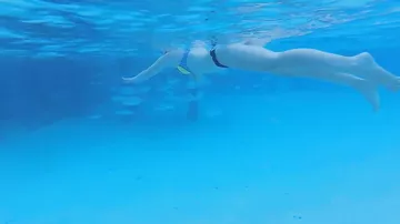 Акула укусила девушку за руку во время "безопасной" подводной экскурсии