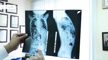 11 aylıq uşağın bədənində 16 iynə tapıldı