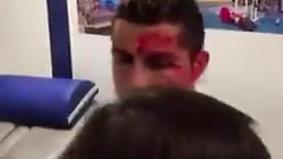 Как выглядел Роналду после травмы в матче с "Депортиво"