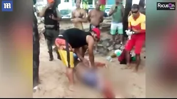 В Бразилии турист лишился ноги после нападения акулы