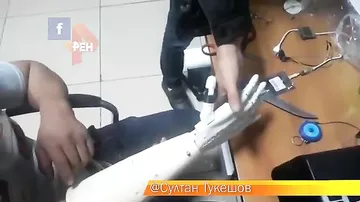 В Киргизии впервые сделали бионический протез руки, управляемый мыслью
