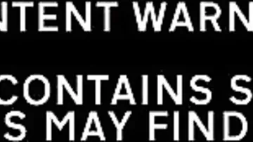 Vəhşicəsinə ov zamanı onlarla it uçurumdan düşüb, öldü