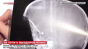 Мальчик с пулей в голове отправился в Петербург на операцию